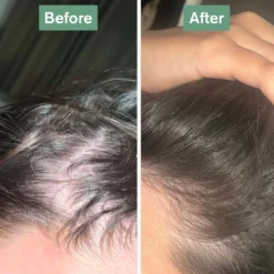 Beauty Bundle -Tv Cabinet Store hairsaviourbefore aftersquareruby2