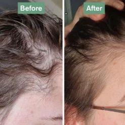 Hair Saviour® -Tv Cabinet Store rebeccahairsaviourbefore aftersquare