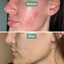 Beauty Bundle -Tv Cabinet Store skinsaviourbefore afterruby